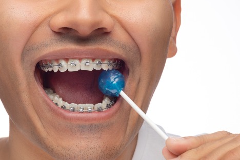 A close-up of a person with braces and a lollipop
