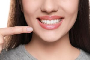 picture of a person smiling, Overbite Teeth Solutions: Treatment Options for a Brighter Smile