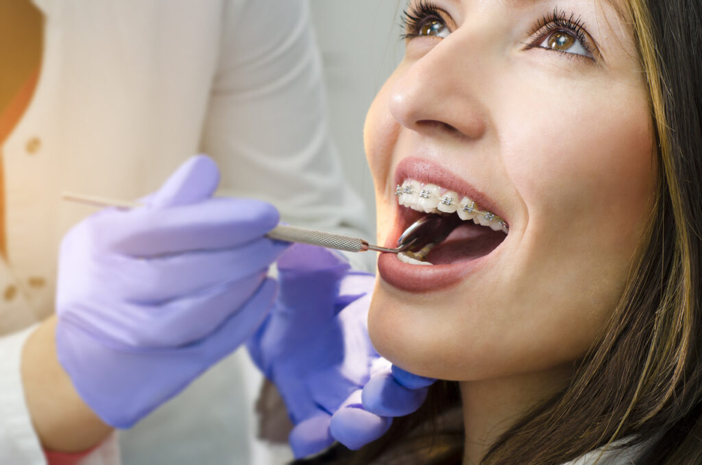 Closeup of beautiful girl with dental braces check up, satisfied smiling, while doctor looking her teeth, Managing Orthodontic Appointments: Scheduling Smiles