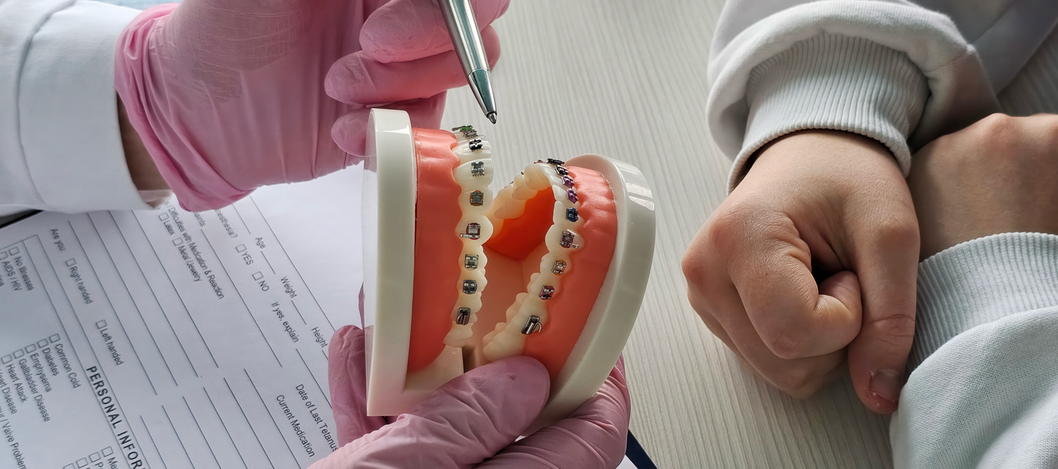 Orthodontic professional explaining braces using a dental model during a consultation.
